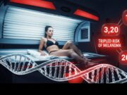 Lettini e lampade solari triplicano il rischio di melanoma? Illustrazione grafica che mostra una donna che usa un lettino solare con un rischio di melanoma evidenziato da un profilo genetico alterato.